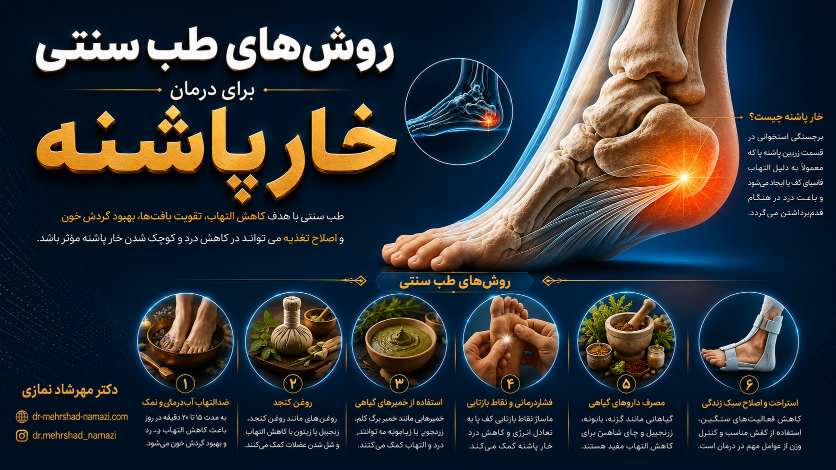 روشهای طب سنتی برای درمان خار پاشنه
