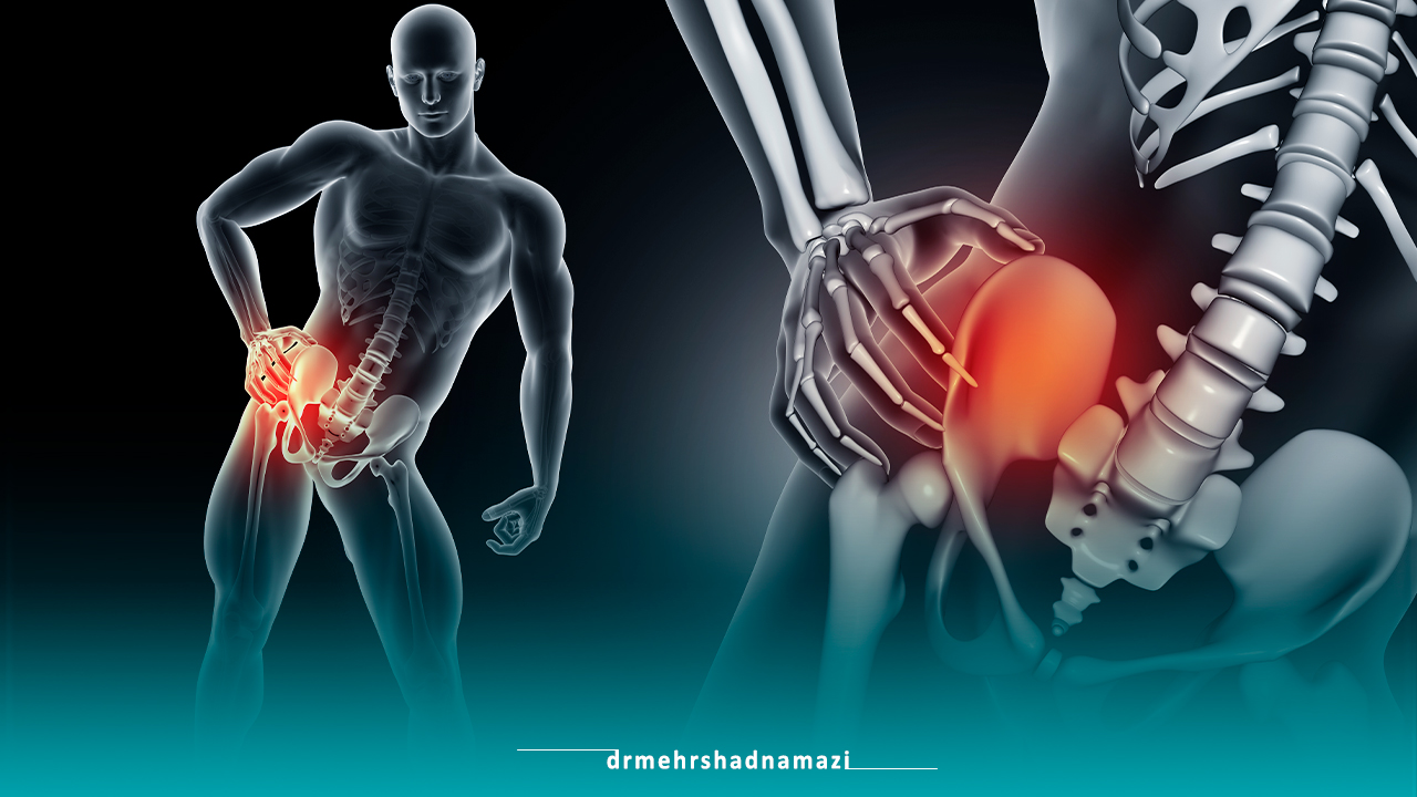 پیشگیری از درد لگن و باسن