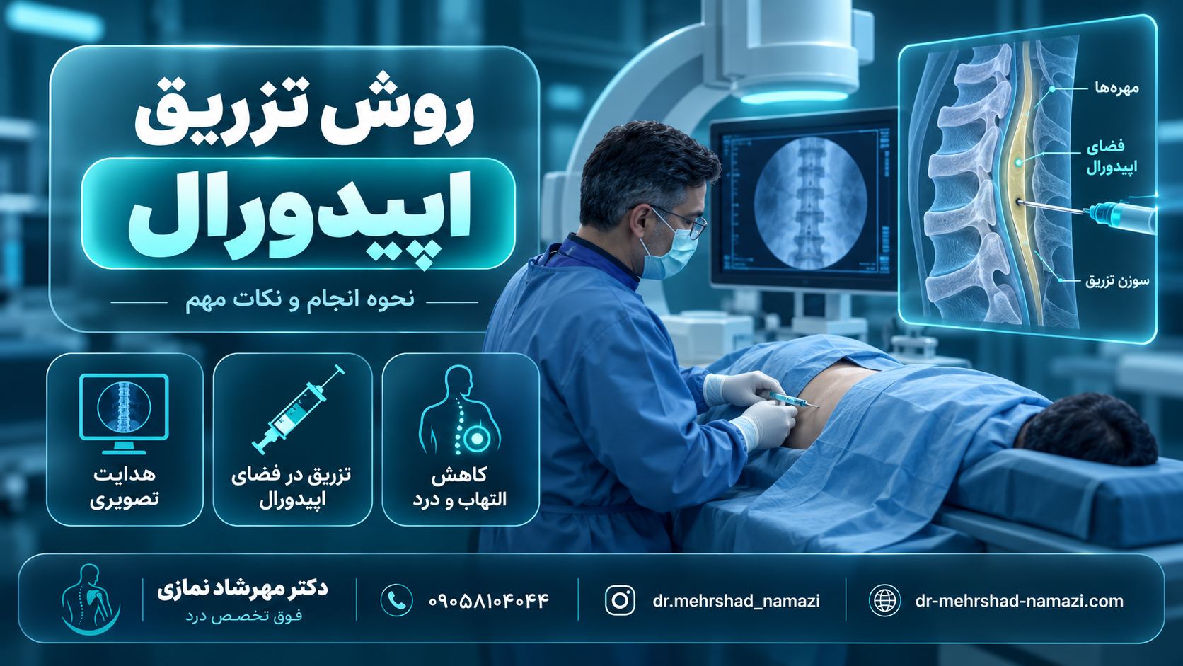 روش تزریق اپیدورال