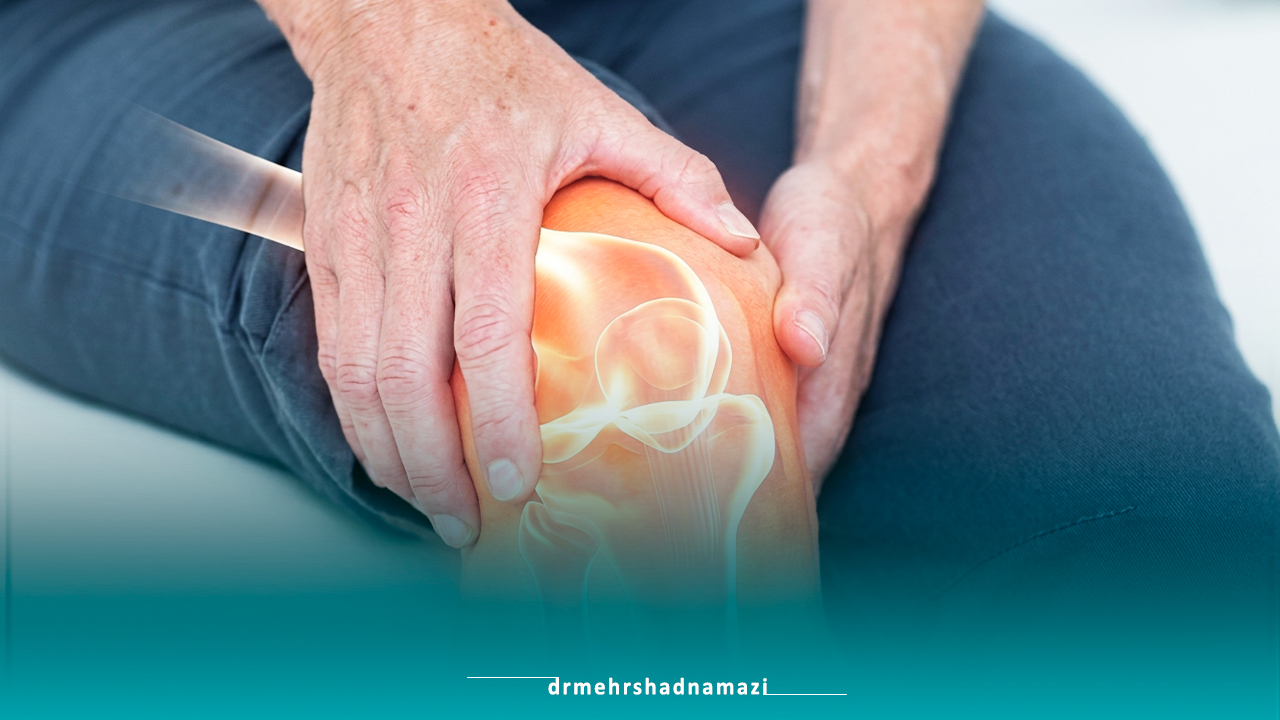 دلایل ابتلا به استئوآرتریت