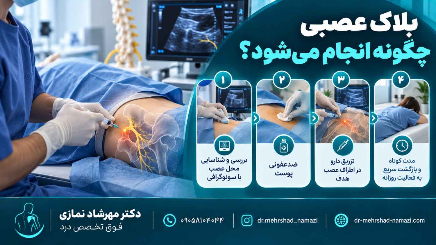 بلاک عصبی چگونه انجام می شود؟