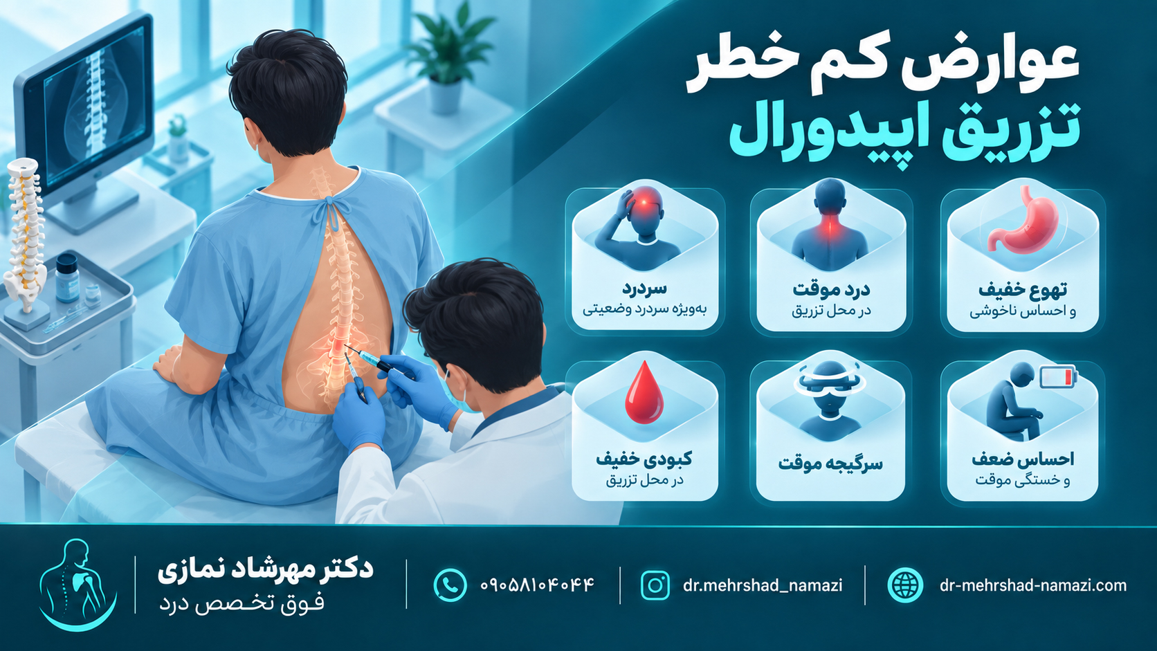 عوارض کم خطر تزریق اپیدورال
