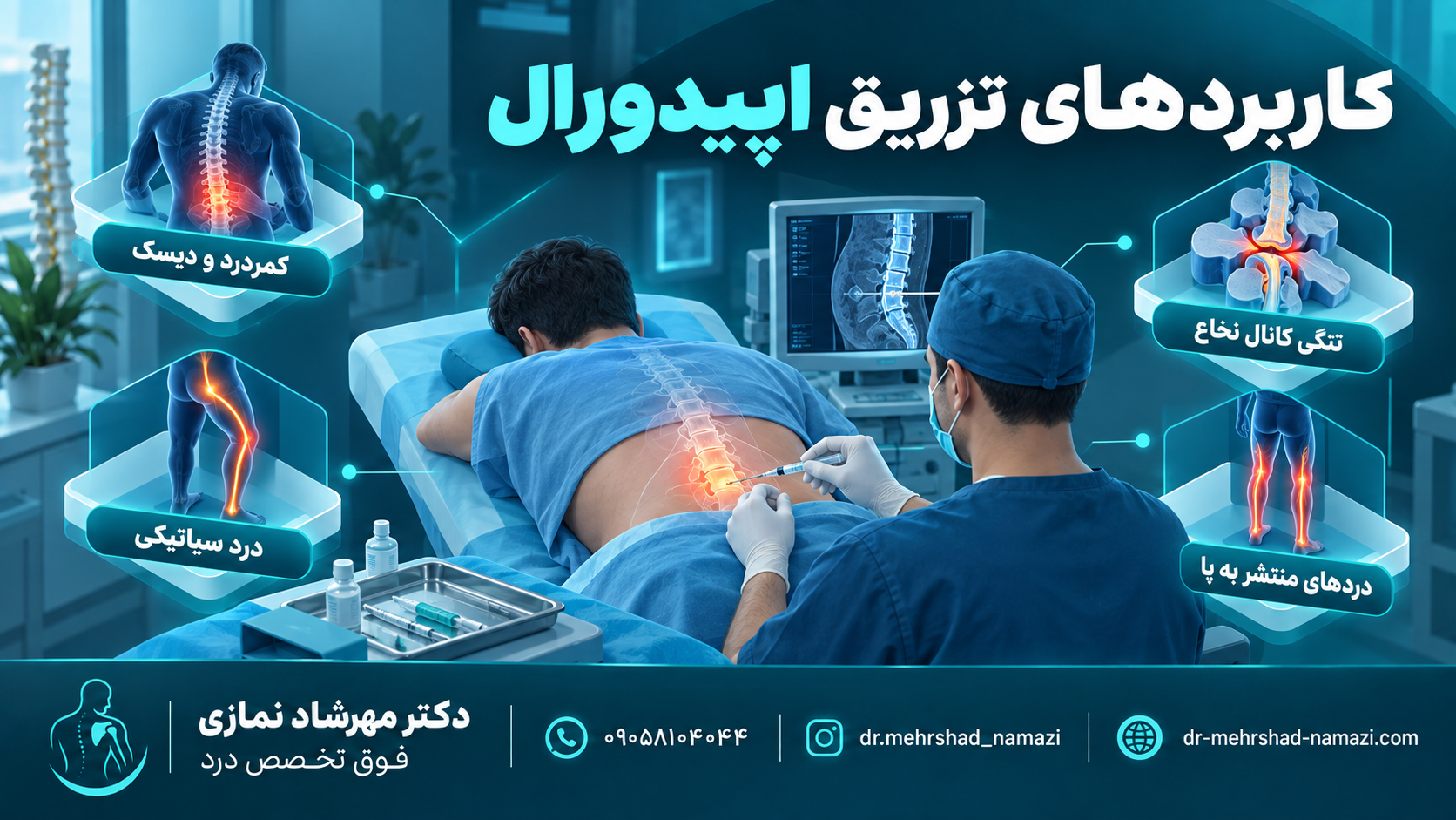 کاربردهای تزریق اپیدورال