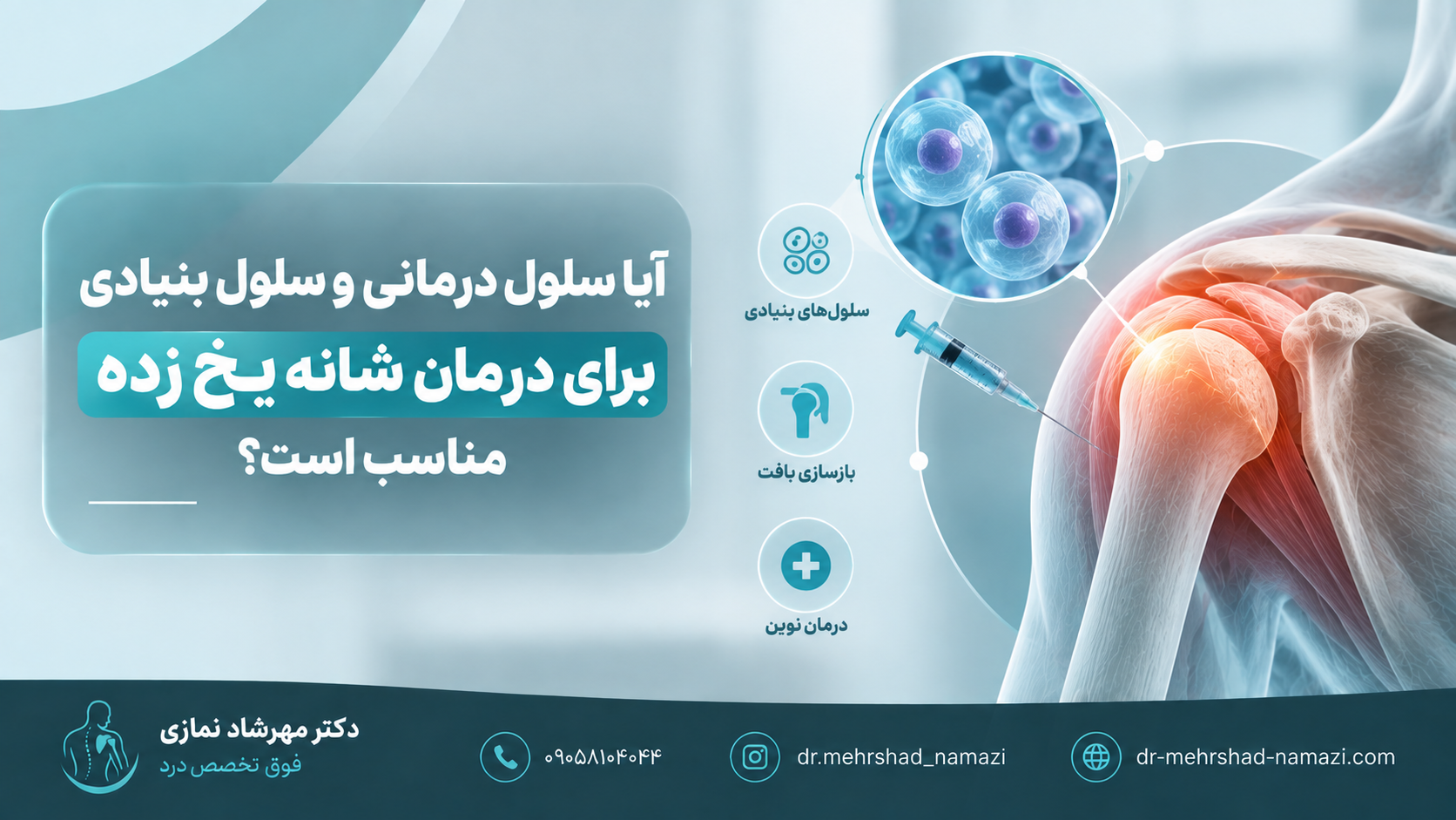 آیا سلول درمانی و سلول بنیادی برای درمان شانه یخ زده مناسب است؟