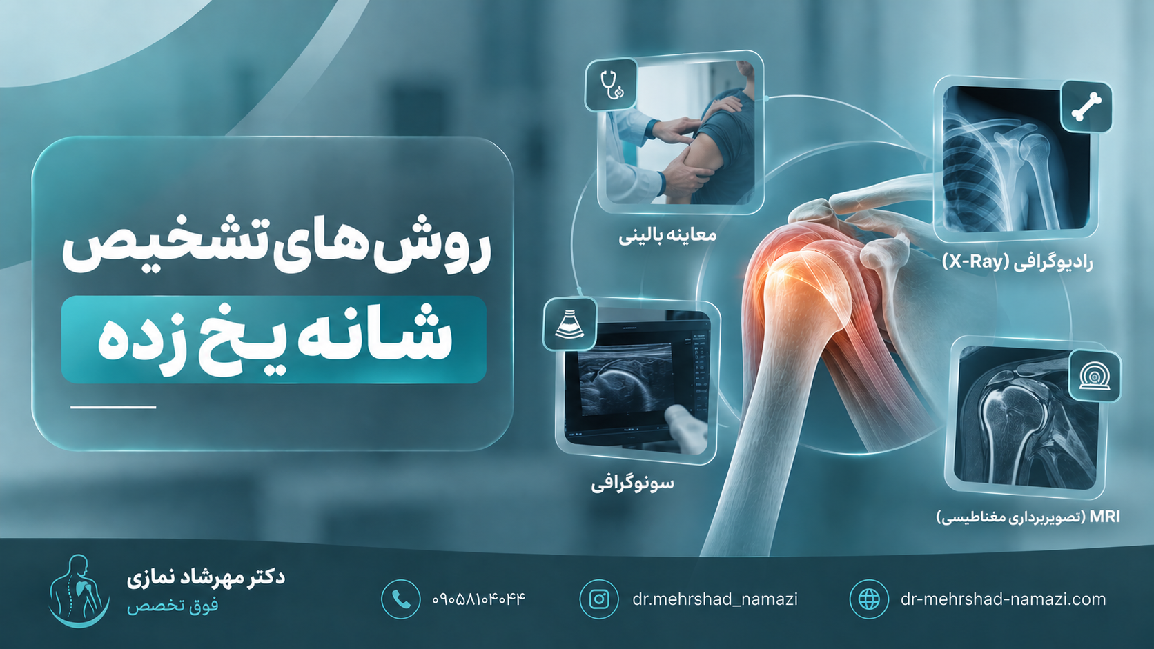 روش های تشخیص شانه یخ زده