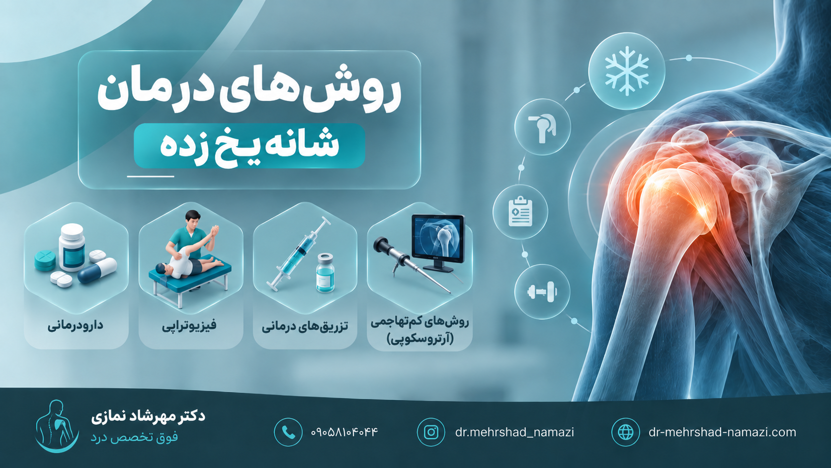 روش های درمان شانه یخ زده