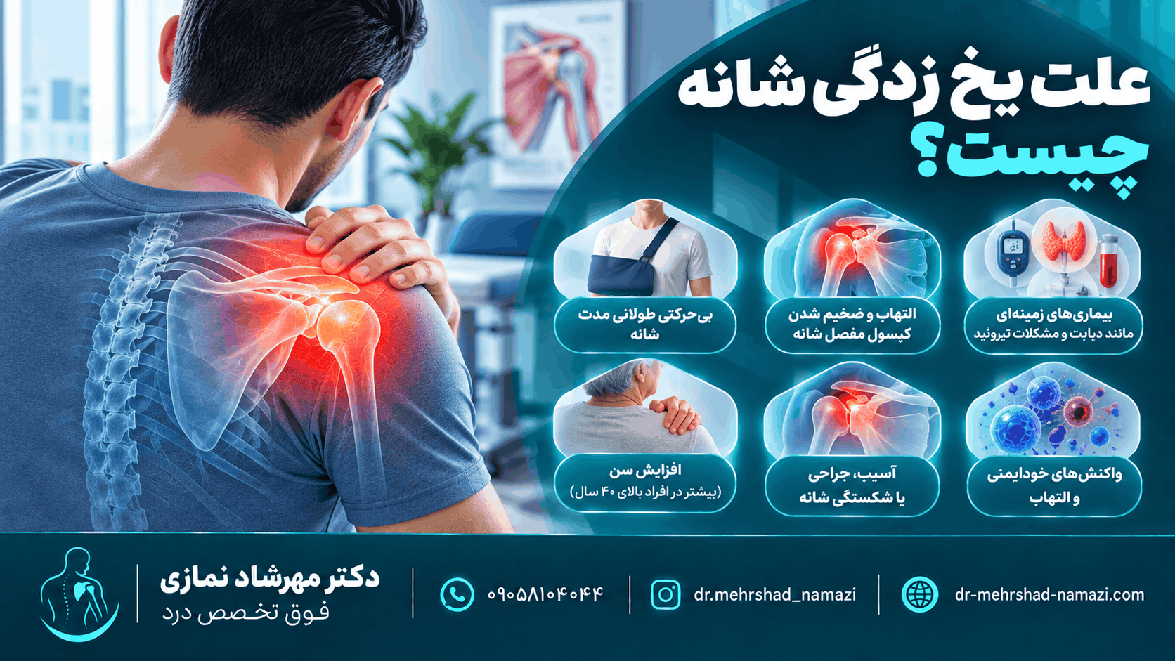 علت یخ زدگی شانه چیست؟